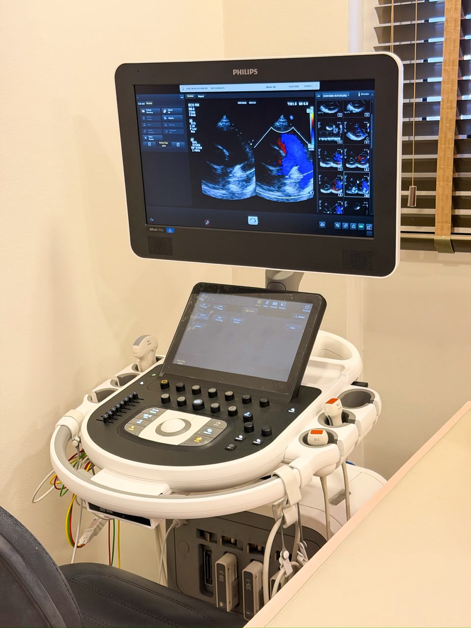 Ecocardiograma sendo realizado em bebê com sonda de ultrassom