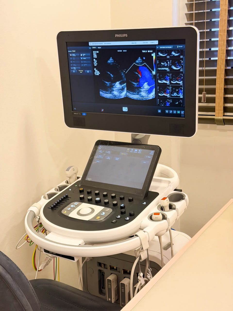 Ecocardiograma sendo realizado em bebê com sonda de ultrassom
